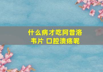 什么病才吃阿昔洛韦片 口腔溃疡呢